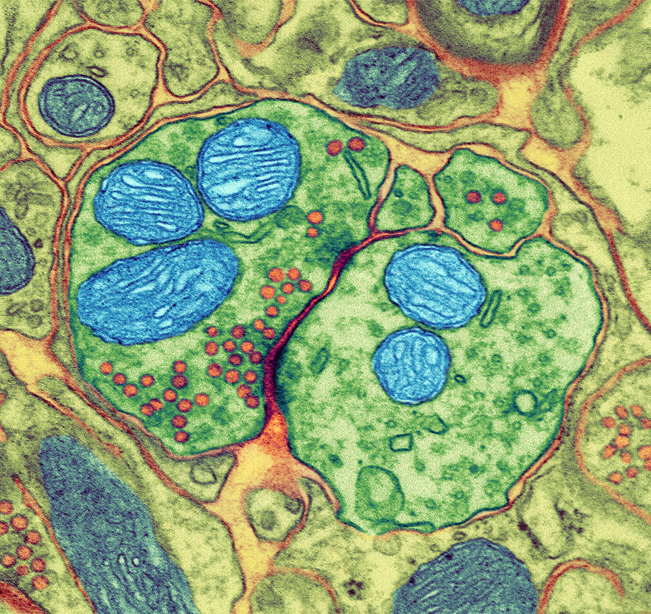 En synapse sett gjennom et elektronmikroskop. Nervecellene er grønne, mitokondriene er blå, og signalstoffene er røde. Mikroskopfoto.