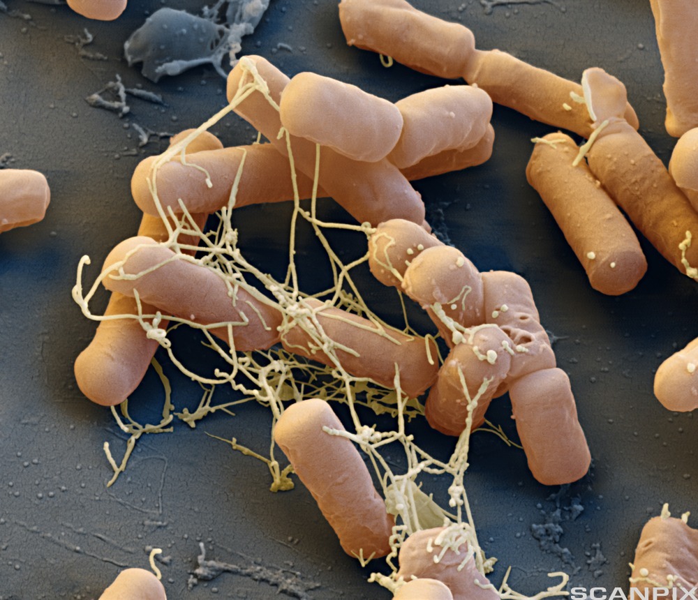 En samling avlange bakterier. Foto tatt gjennom elektronmikroskop.