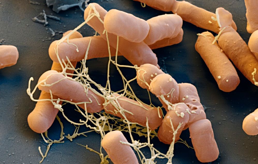 En samling avlange bakterier. Foto tatt gjennom elektronmikroskop.