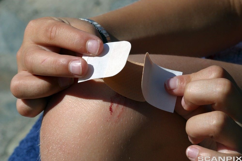 Person som setter et plaster på et skrubbsår på kneet. Foto.