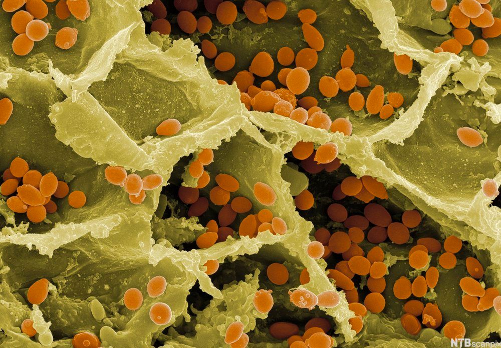 Mikroskopfoto av mange sirkulære gjærsoppceller som sitter på en drue