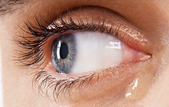 Nærbilde av øye med tårer. Foto.