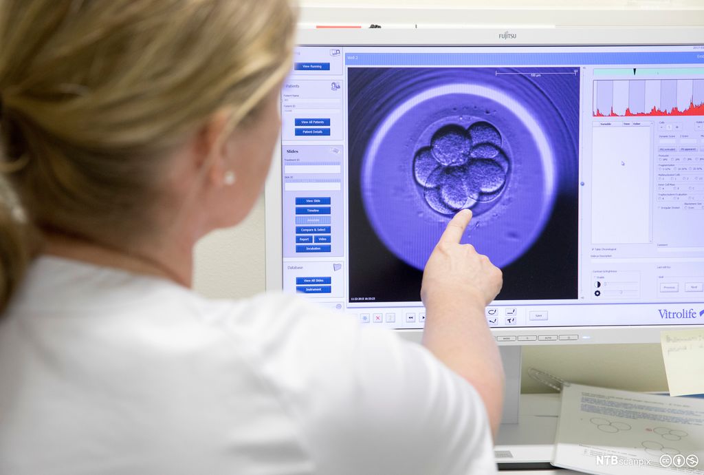 Kvinne peker på skjerm som viser befruktet eggcelle. Foto.