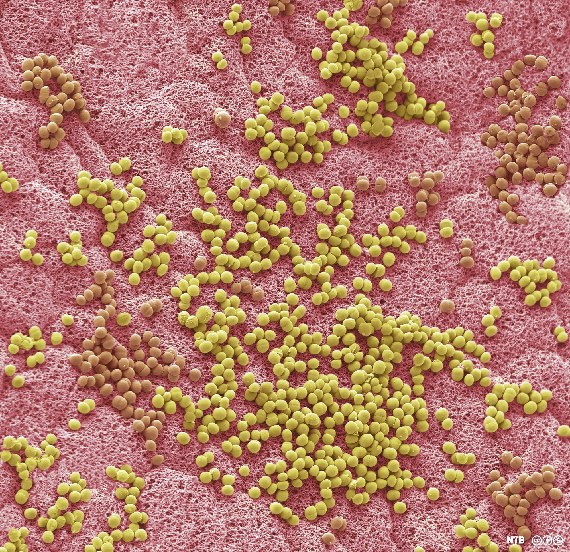 Bakterier i armhulen. Mikroskopfoto.