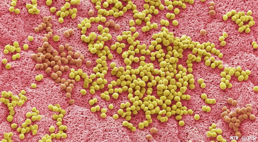 Bakterier i armhulen. Mikroskopfoto.