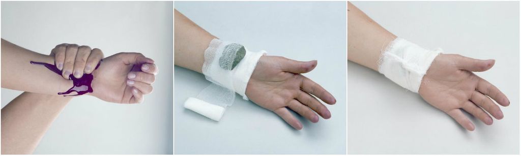 Tre bilder. På første bilde holder en person rundt et håndledd med et blødende sår. På andre bilde er det en bandasje over såret med en stein på. På tredje bilde er det bandasje over steinen. Foto.