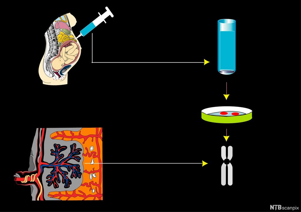 Ohkediagnostihkalaš illustrašuvdna
