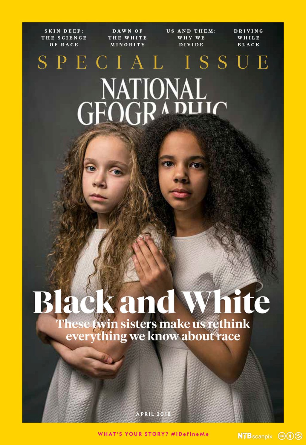 Tvillinger med to ulike farger på coveret til National Geographic. Cover.